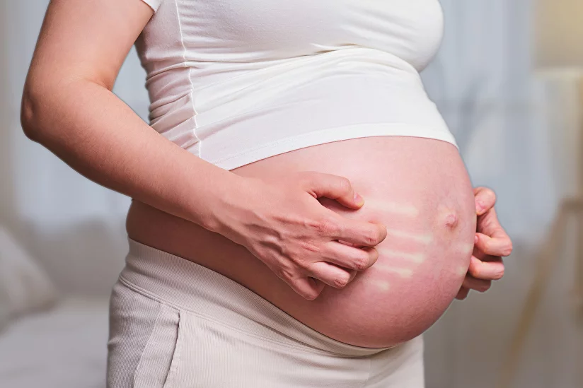 О чем расскажет кожа лица при беременности | MUSTELA