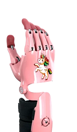Преимущества бионического протеза руки