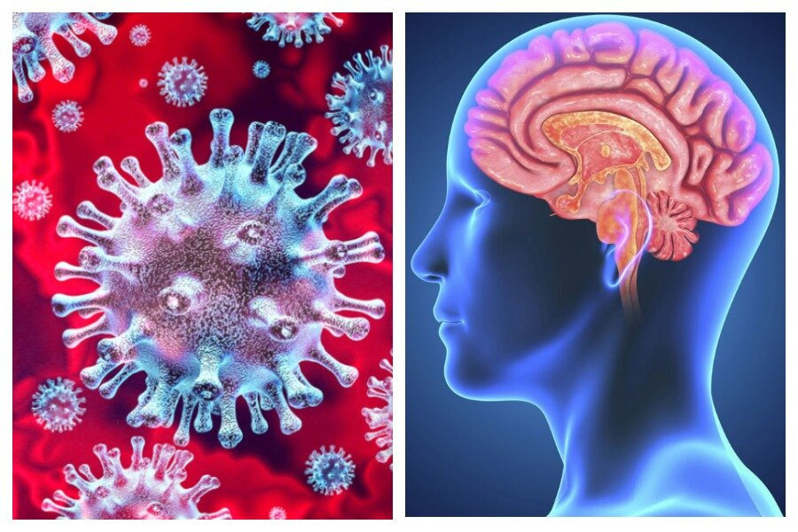 Переболела коронавирусом какие. Влияние коронавируса на мозг. Неврологические вирус. Влияние коронавируса на мозг и нервную систему человека. Неврологические последствия коронавируса.
