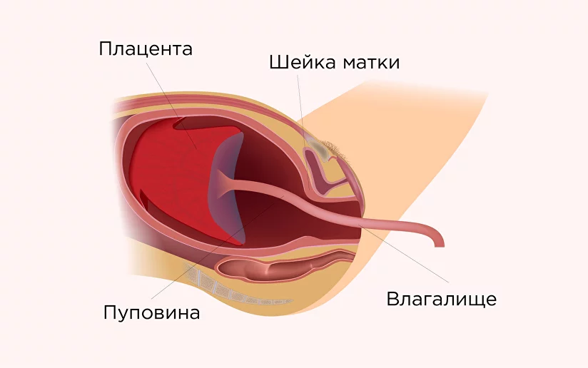 Общие сведения о вагините (инфекция или воспаление влагалища)