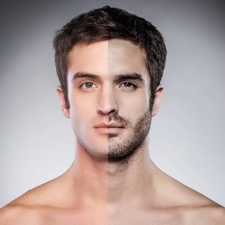 5 способов избавиться от волос на лице: какой подойдет тебе?