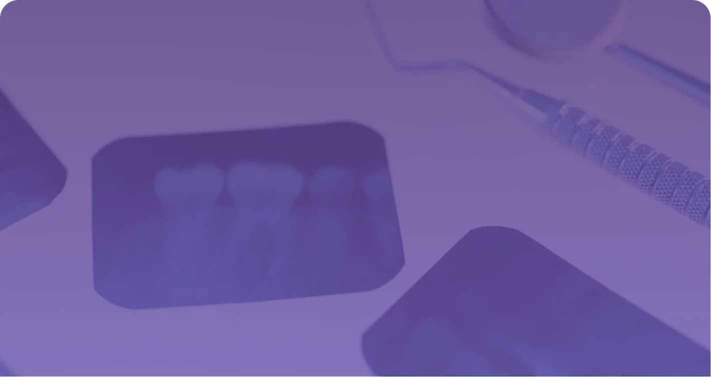 Зубы и воспаление тройничного нерва