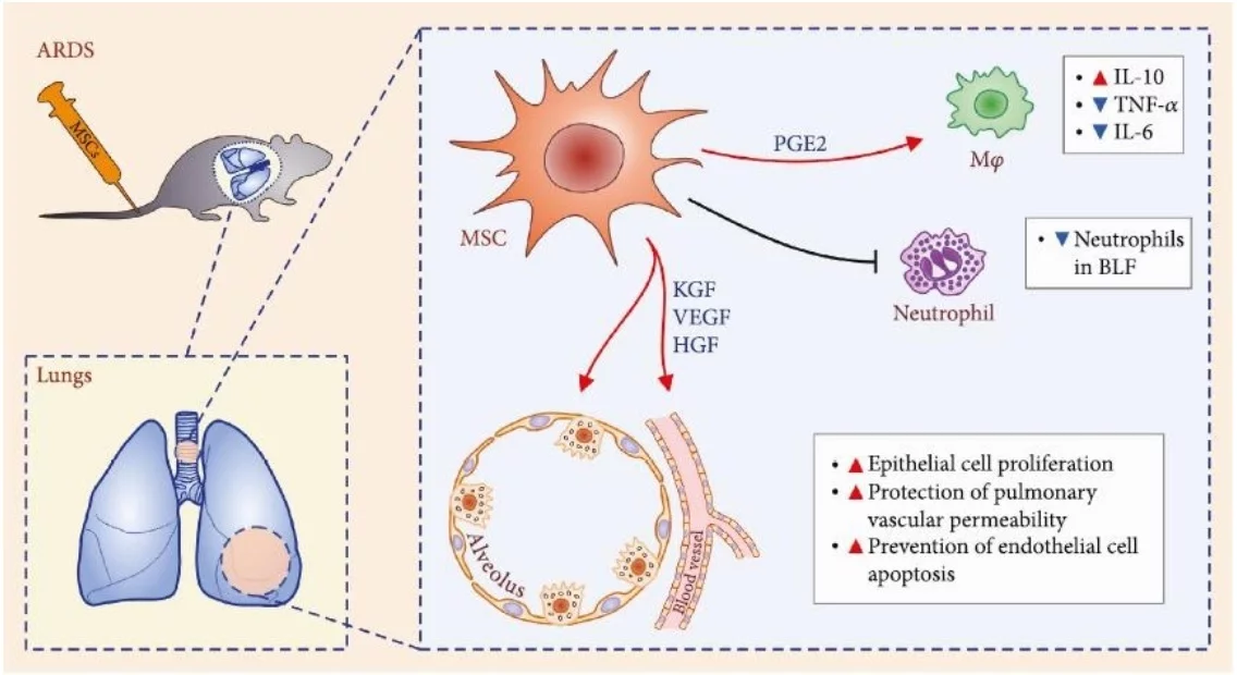 Le Potentiel des Cellules Souches Mésenchymateuses dans le Traitement des Complications de L'infection du Coronavirus COVID-19