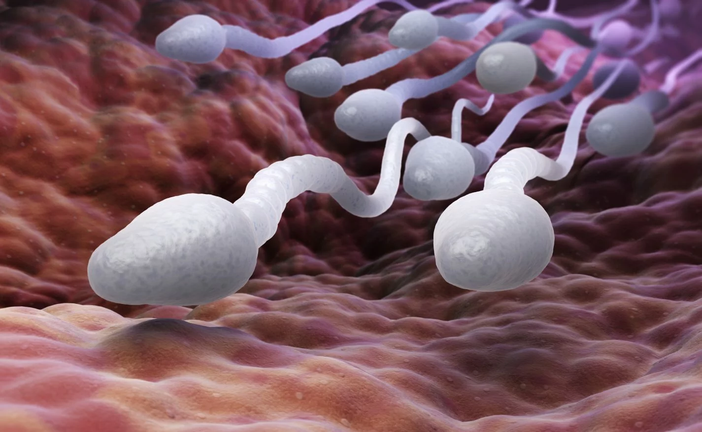 Морфология сперматозоидов по Крюгеру при мужском бесплодии. Отклонения от нормы