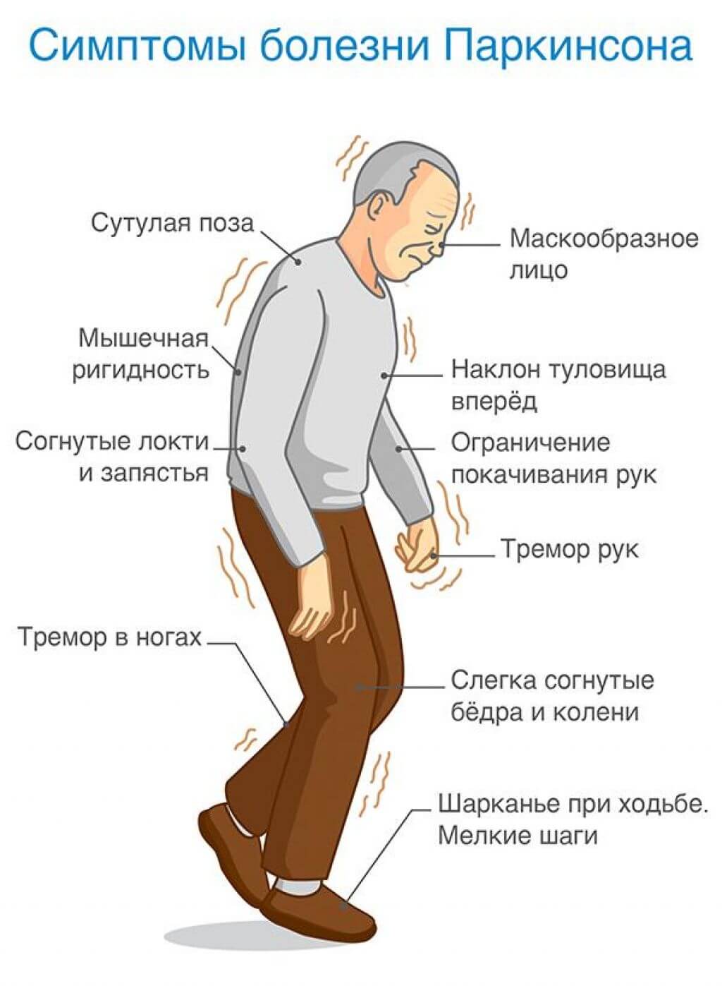 Деменция — признаки и лечение деменции в Киеве, в диагностической клинике Vivere