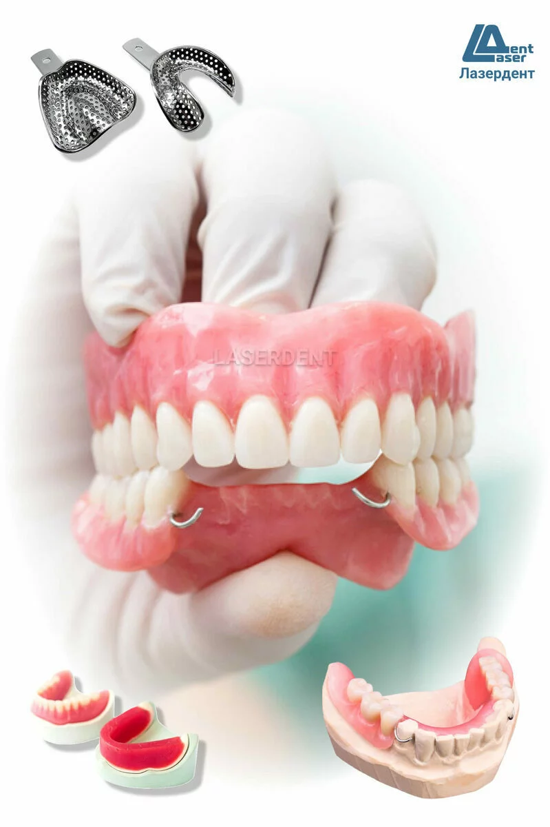 Приварка зуба к съемному протезу