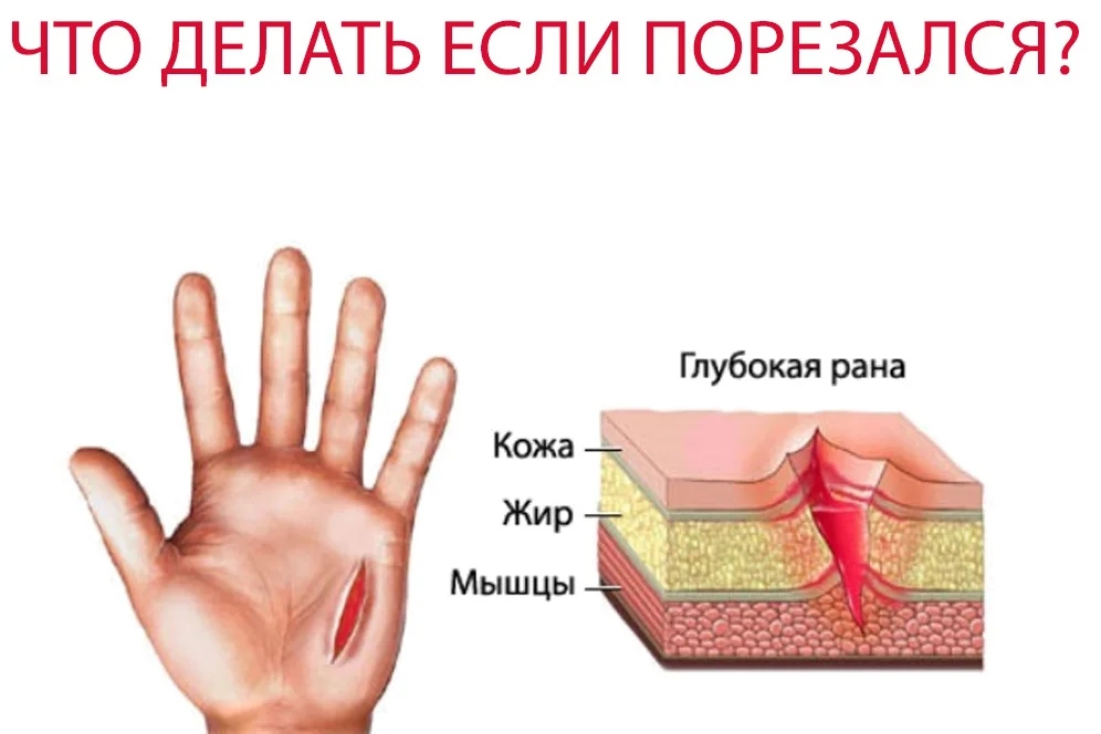 Рана или царапина на руке